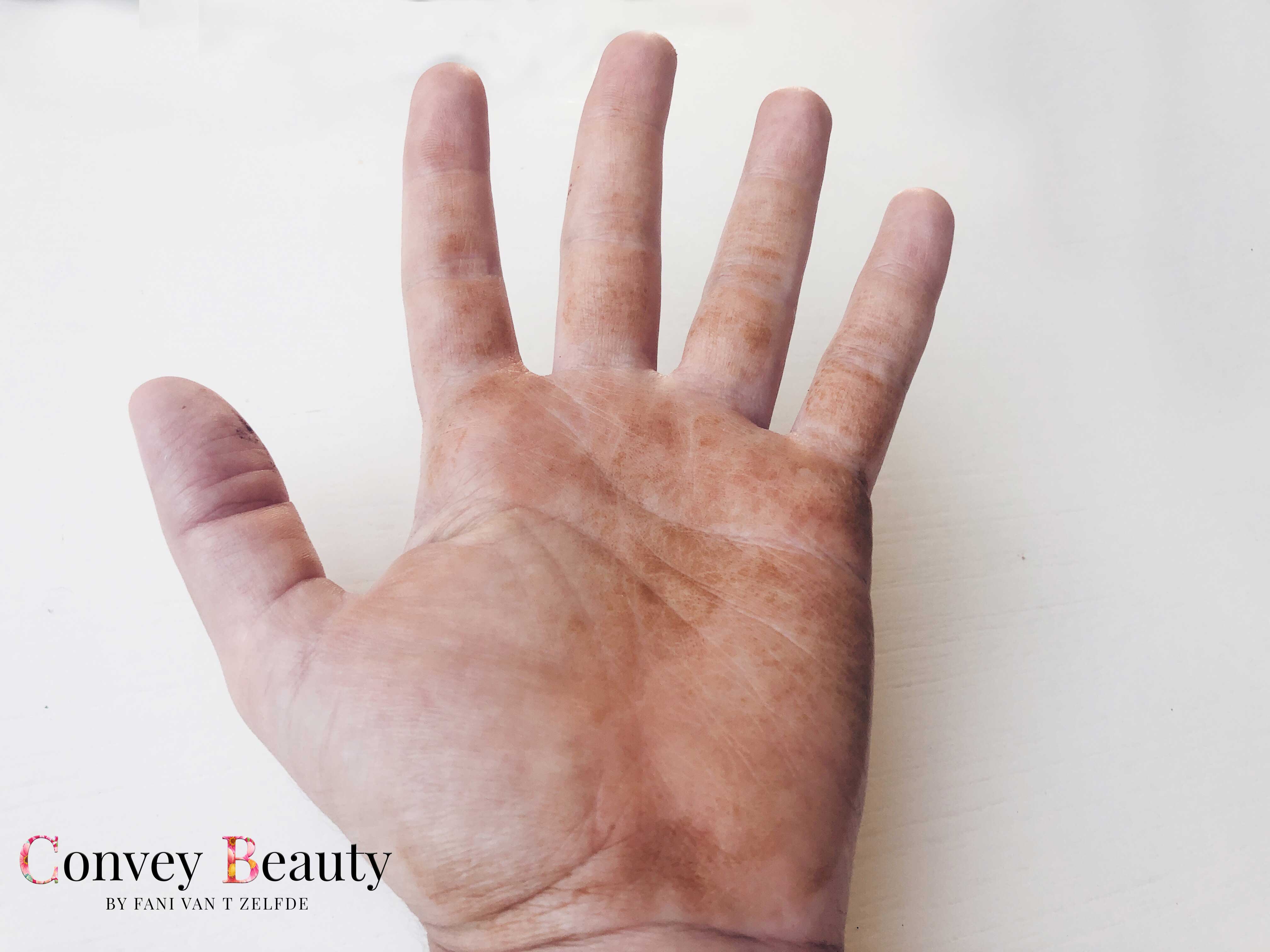 7 manieren om oranje handen door zelfbruiners te verwijderen
